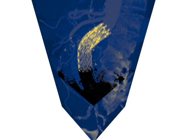volume render1