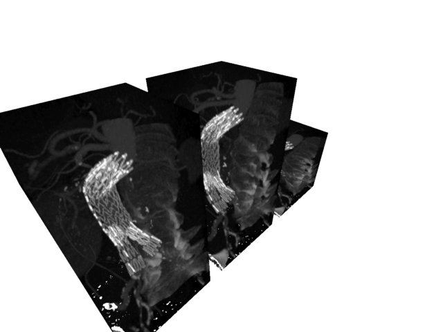 volume render2