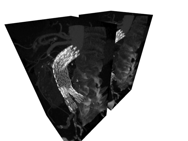 world bounding box
