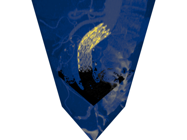 volume render1