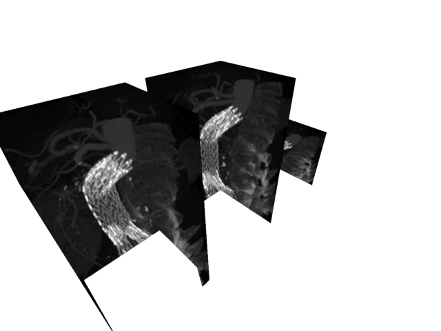 volume render2