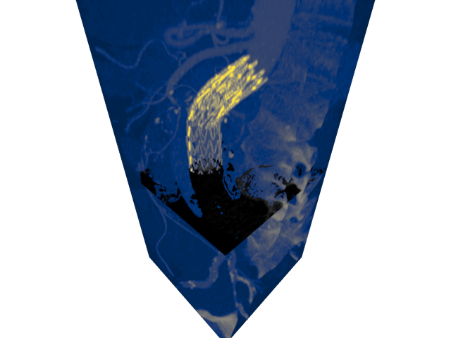 volume render1