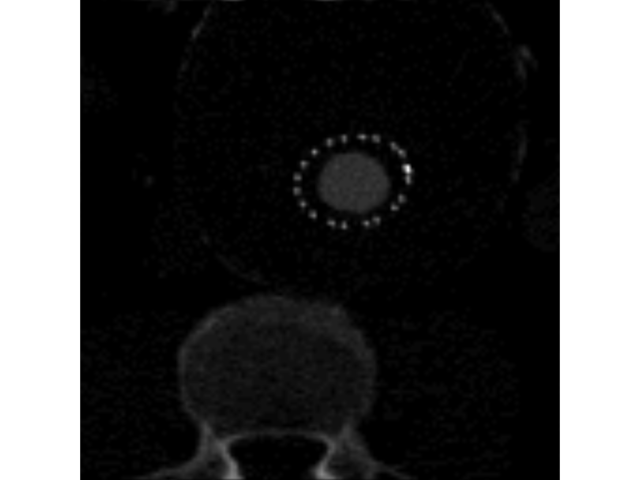 volume slice1