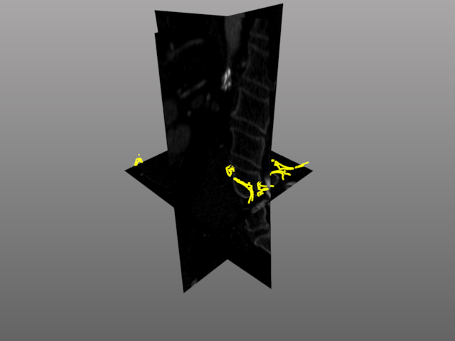 multi slice2