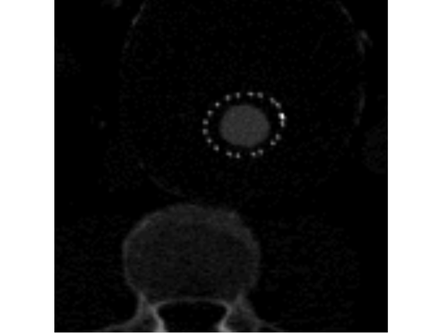 volume slice3