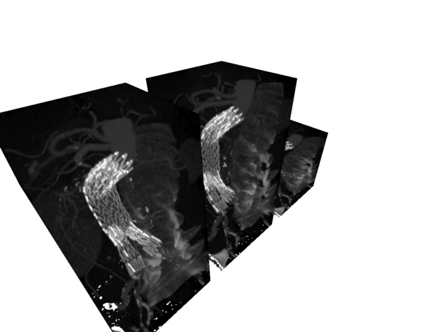 volume render2